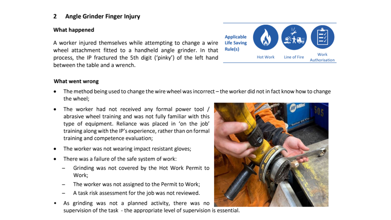Angle Grinder Finger Injury
