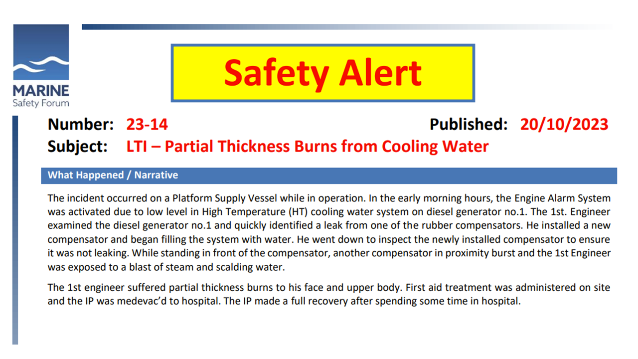LTI Partial Thickness Burns from Cooling Water