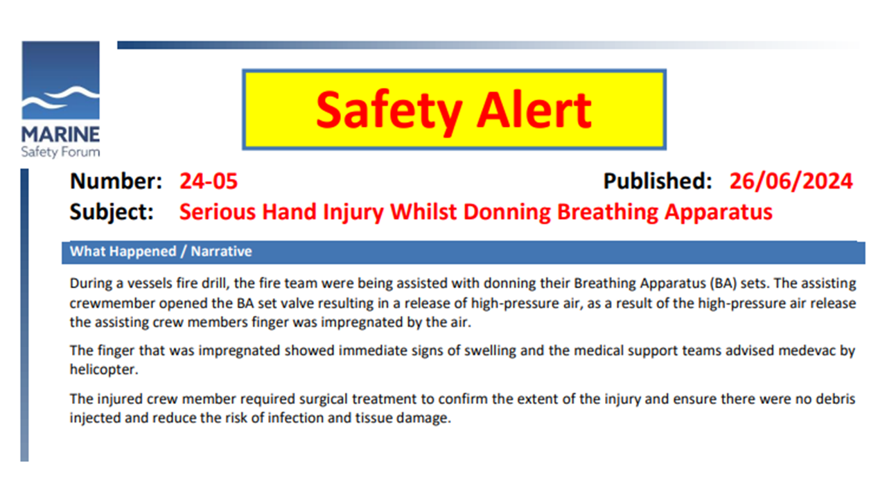 Serious Hand Injury Whilst Donning Breathing Apparatus