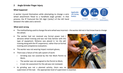 Angle Grinder Finger Injury