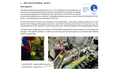 Chemical Handling Eye Burn