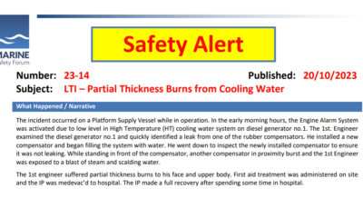 LTI Partial Thickness Burns from Cooling Water