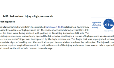Serious hand injury high pressure air