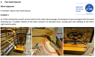 Two Hand Injuries